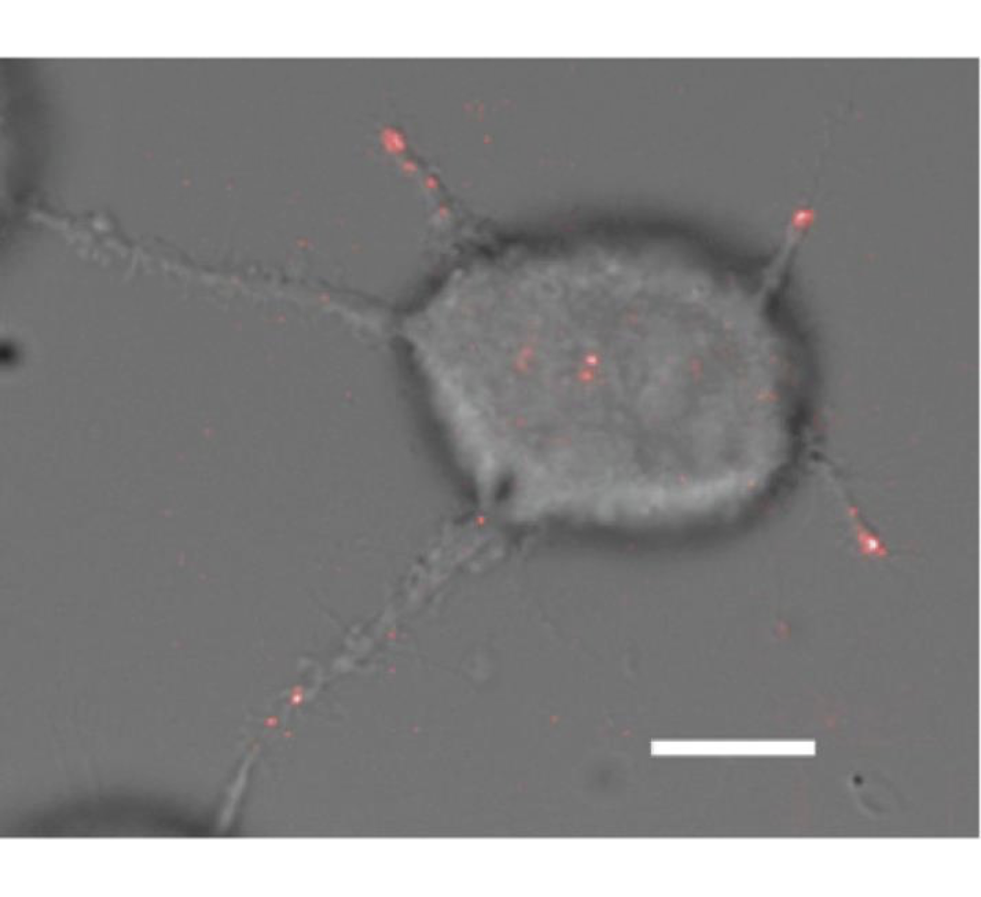 Superposition of a DIC image of an MCF-7 cell and the FRET signal indicating focal adhesions