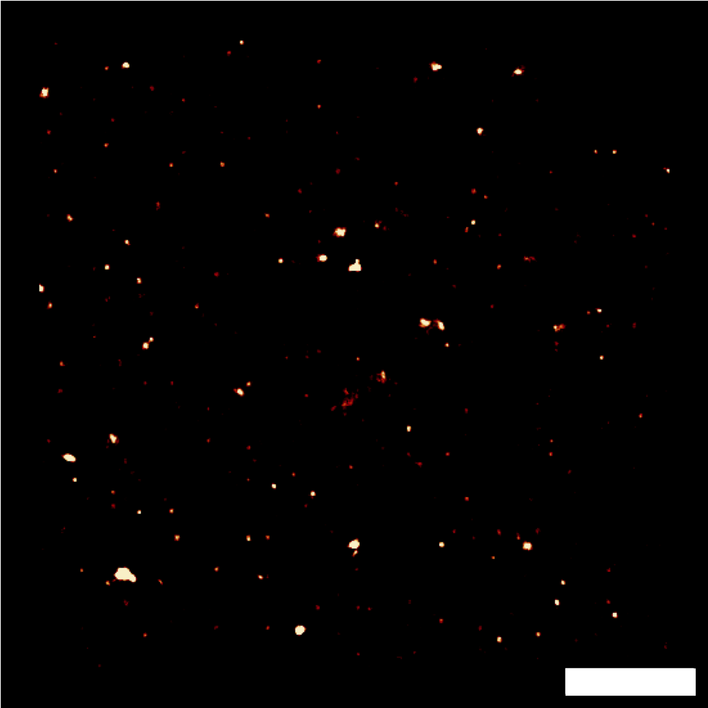 Image reconstructed by the SRRF algorithm from 100 images