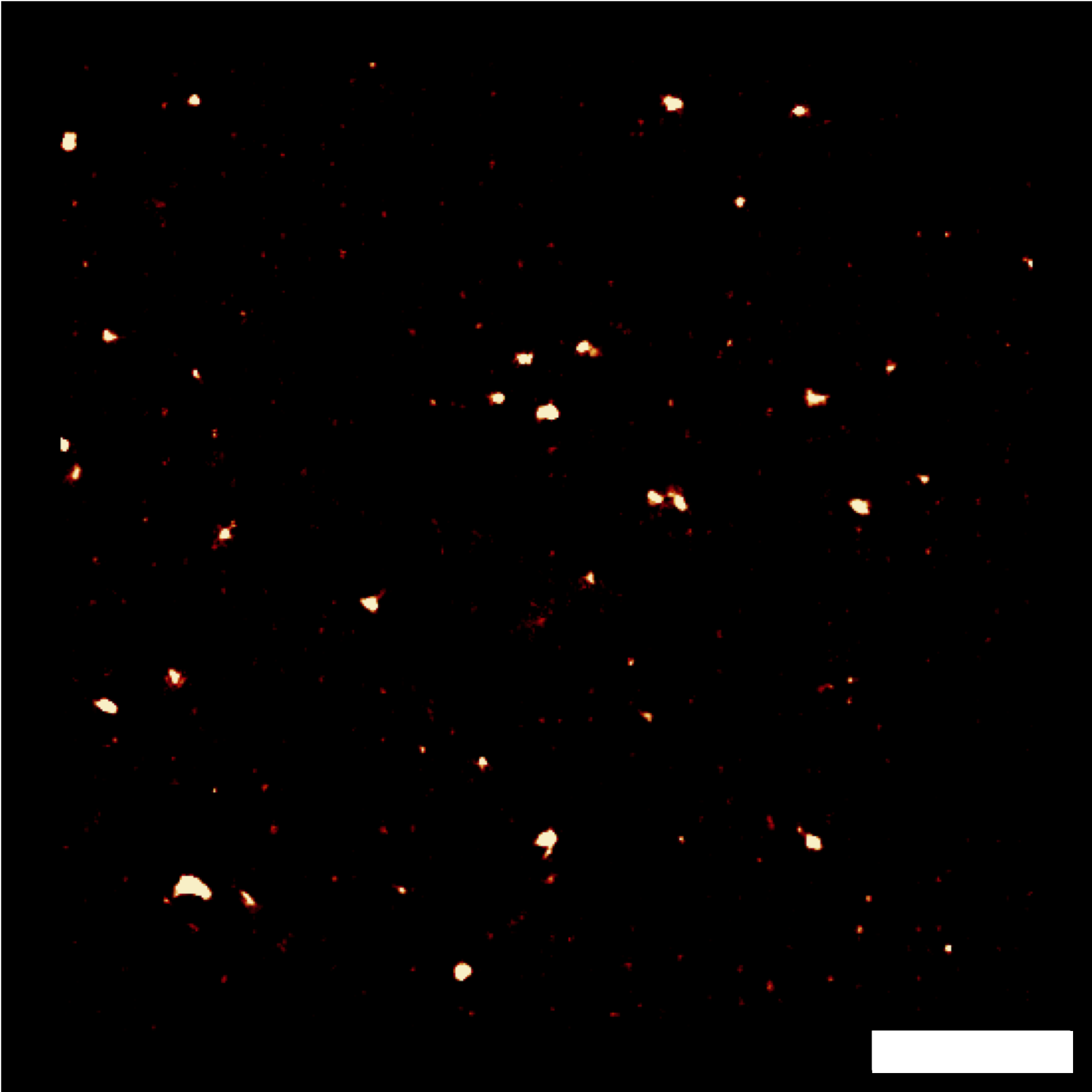 Image reconstructed by the SRRF algorithm from 1000 images